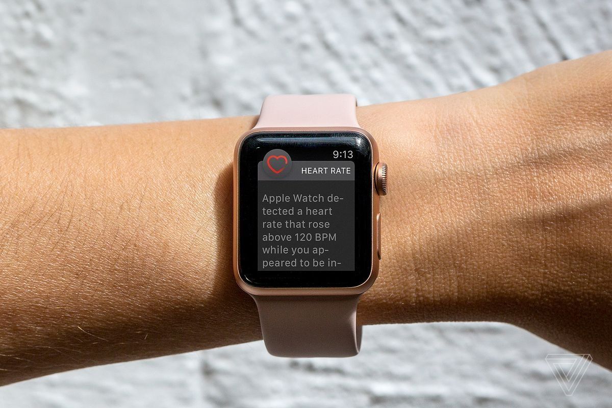 Montres intelligentes Apple watch série 4 - avantages et inconvénients
