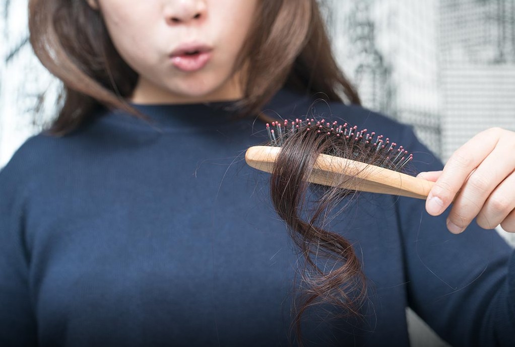 The Best Hair Loss Treatments in 2022