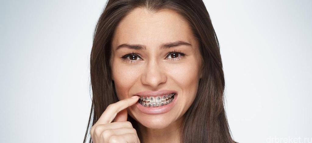 Rating of the best waxes for braces for 2022