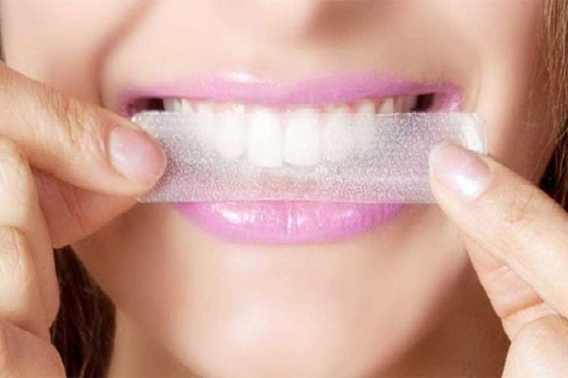 Topbedømte tandblegningsstrimler for 2022