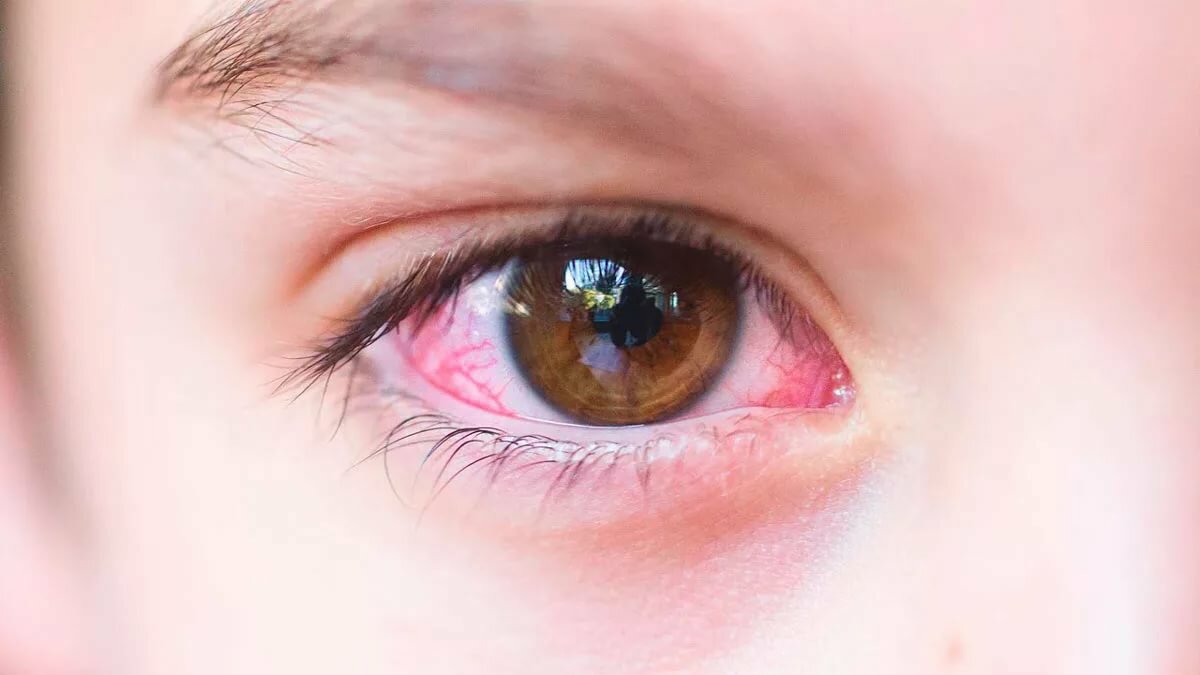 Rating of the best drops from conjunctivitis for 2022
