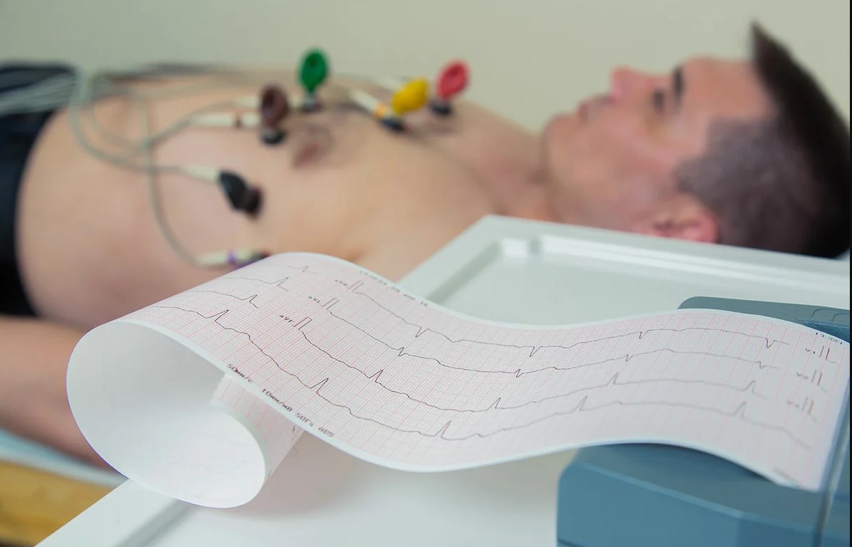 Rating of the best electrocardiographs for 2022