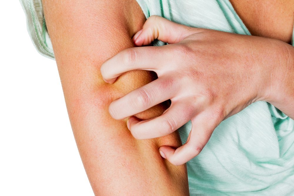 Rating of the best remedies for itchy skin for 2022
