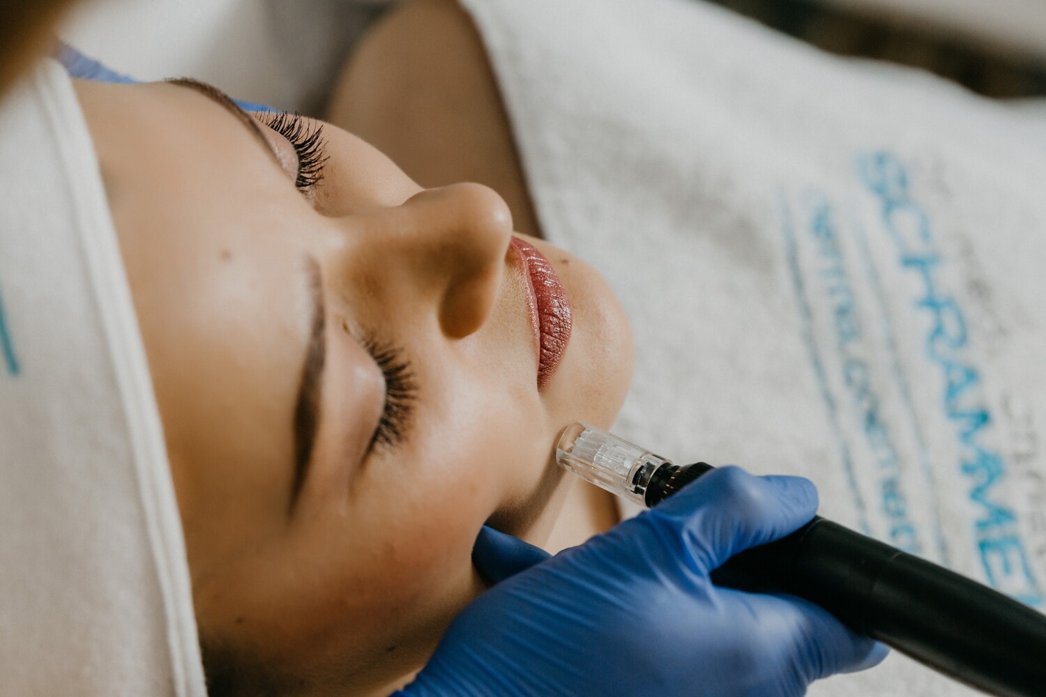 The best hardware technologies for facial rejuvenation and lifting for 2022