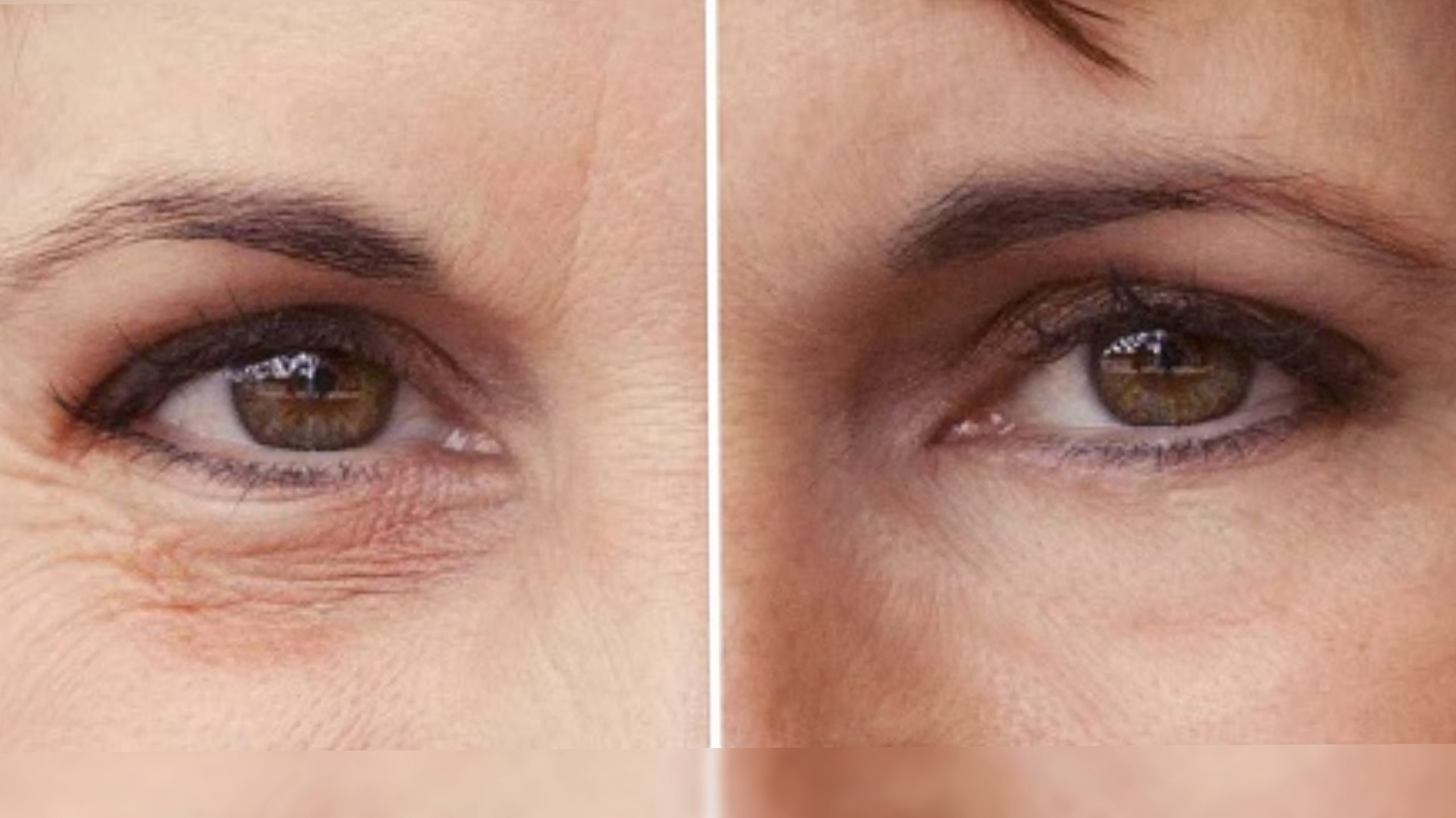 Ranking of the best creams for wrinkles around the eyes for 2022